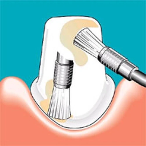 Sonicflex clean brush №6 - насадка-щетка валик большой для чистки зубов, 5 шт. | KaVo (Германия)