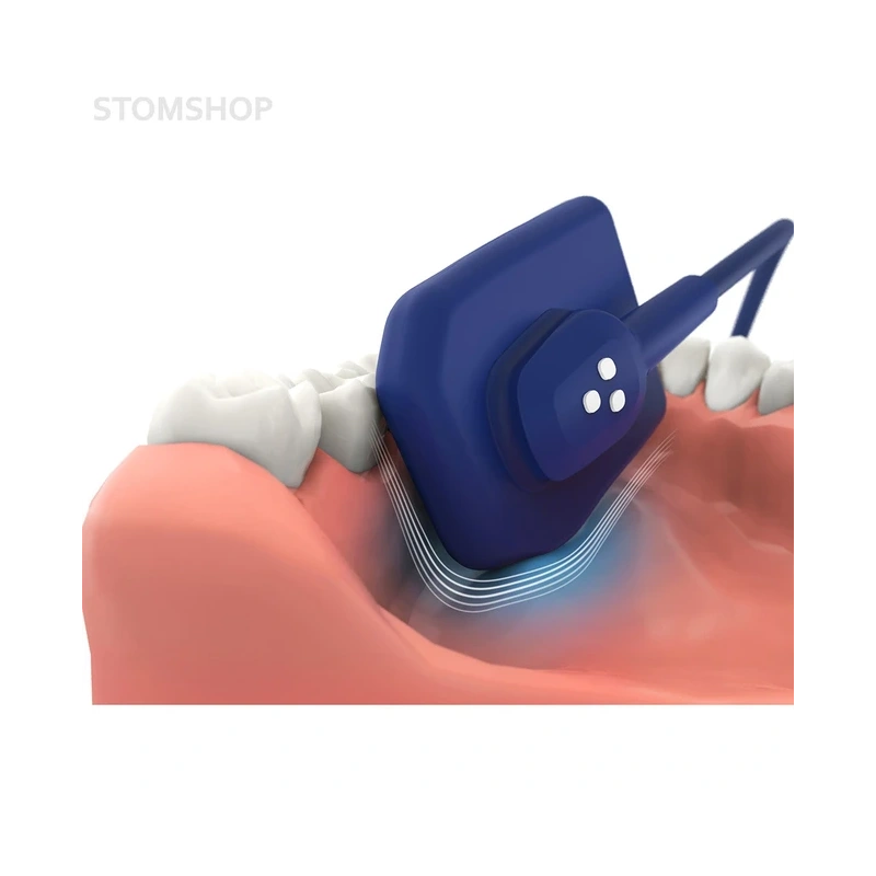 EzSensor Soft 1.5 - цифровой радиовизиограф, размер 1.5 | Vatech (Ю. Корея)