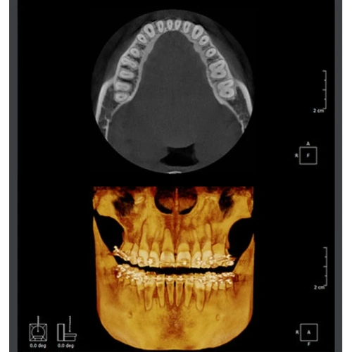 RAYSCAN Symphony Alpha OCS – ортопантомограф c цефалостатом (One Shot), 30х25 см | Ray Co., Ltd. (Ю. Корея)