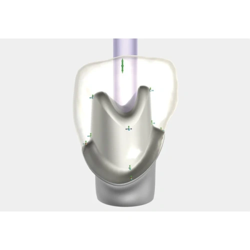 Exocad Implant Module - модуль для создания имплантов | Exocad (Германия)