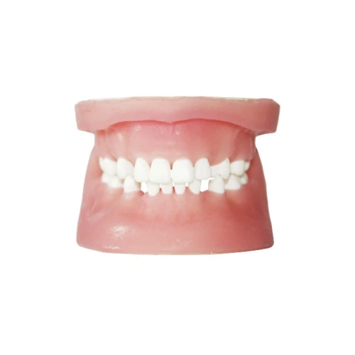 E34 – модель верхней и нижней челюсти с частичной адентией для хирургической практики | GF Dental (Италия)