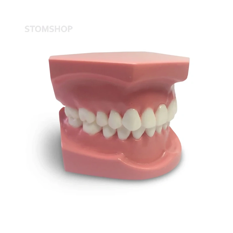 ORB01 – ортодонтическая модель с брекетами и твердой десной, 1 класс | GF Dental (Италия)