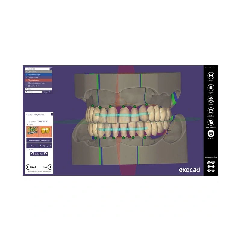 Exocad Full Denture Module - модуль для создания полносъемных протезов | Exocad (Германия)