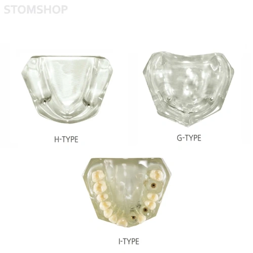 CRYSTAL IMPLANT MODEL - модель для демонстрации установки имплантатов | Hanil (Ю. Корея)