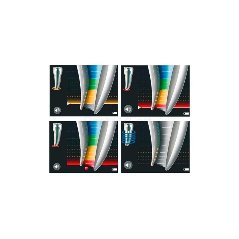 Raypex 6 - электронно-цифровой апекслокатор 6-го поколения | VDW GmbH (Германия)