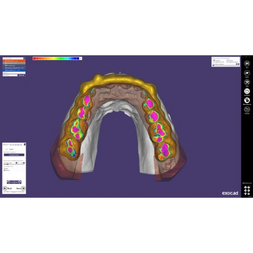Exocad Bite Splint Module - модуль для создания терапевтических капп | Exocad (Германия)