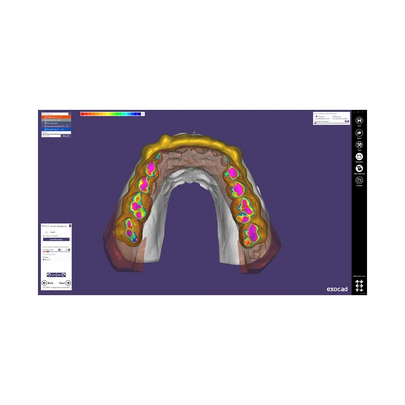 Exocad Bite Splint Module - модуль для создания терапевтических капп | Exocad (Германия)
