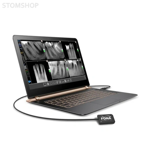 Fona StarX PRO - цифровой радиовизиограф | FONA Dental s.r.o. (Италия)