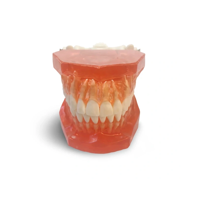 ETR1 – модель верхней и нижней челюсти для практики и демонстрации | GF Dental (Италия)
