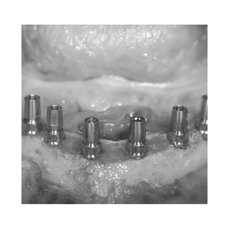 LM Implant Misura MR 3.4-5.8 - инструмент для позиционирования имплантатов | LM-Instruments Oy (Финляндия)