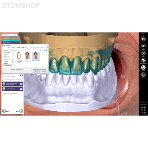 Exocad Smile Creator - модуль для планирования улыбки | Exocad (Германия)