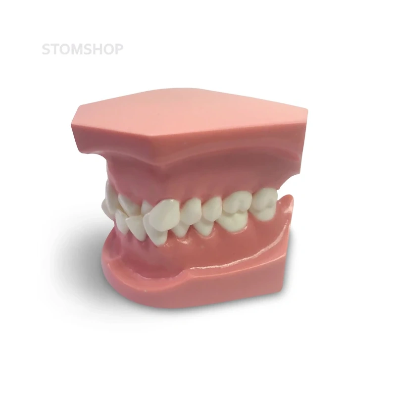 ORB02 – ортодонтическая модель с брекетами и твердой десной, 1 класс | GF Dental (Италия)