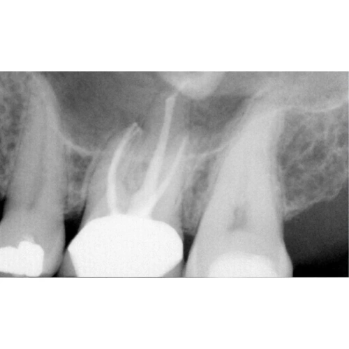 FONA CDR powered by SCHICK - система компьютерной стоматологической радиографии | FONA Dental s.r.o. (Италия)