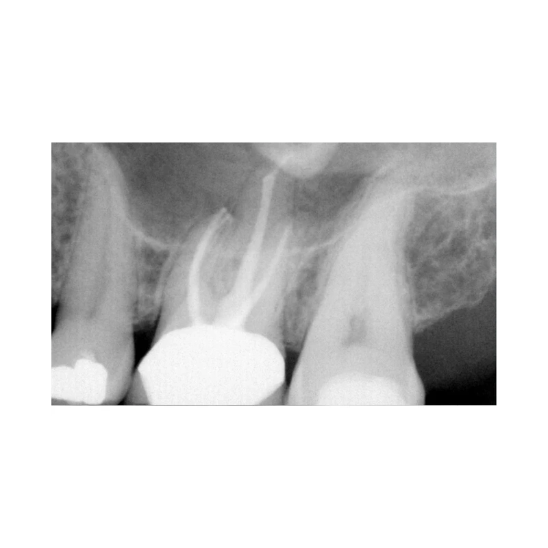 FONA CDR powered by SCHICK - система компьютерной стоматологической радиографии | FONA Dental s.r.o. (Италия)