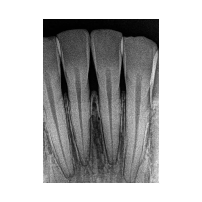 Kodak RVG 5200 - радиовизиограф, 16 пар линий/мм | Carestream Dental (США)