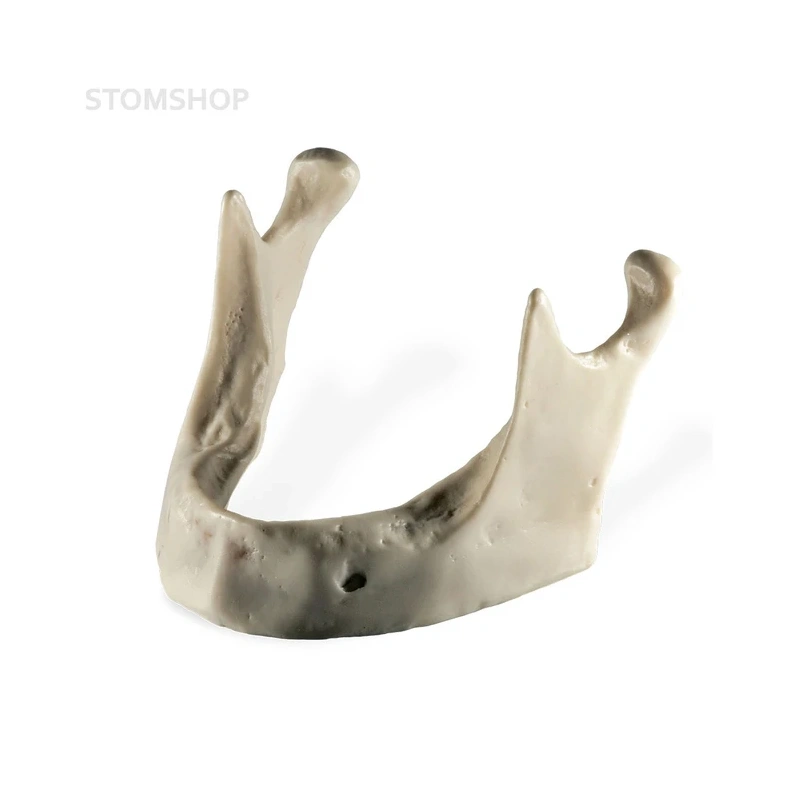 Модель кости нижней челюсти для проведения имплантации | Dentalstore (Италия)