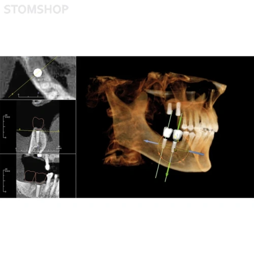 OP 3D Vision - аппарат панорамный рентгеновский стоматологический с функцией томографии | KaVo (Германия)