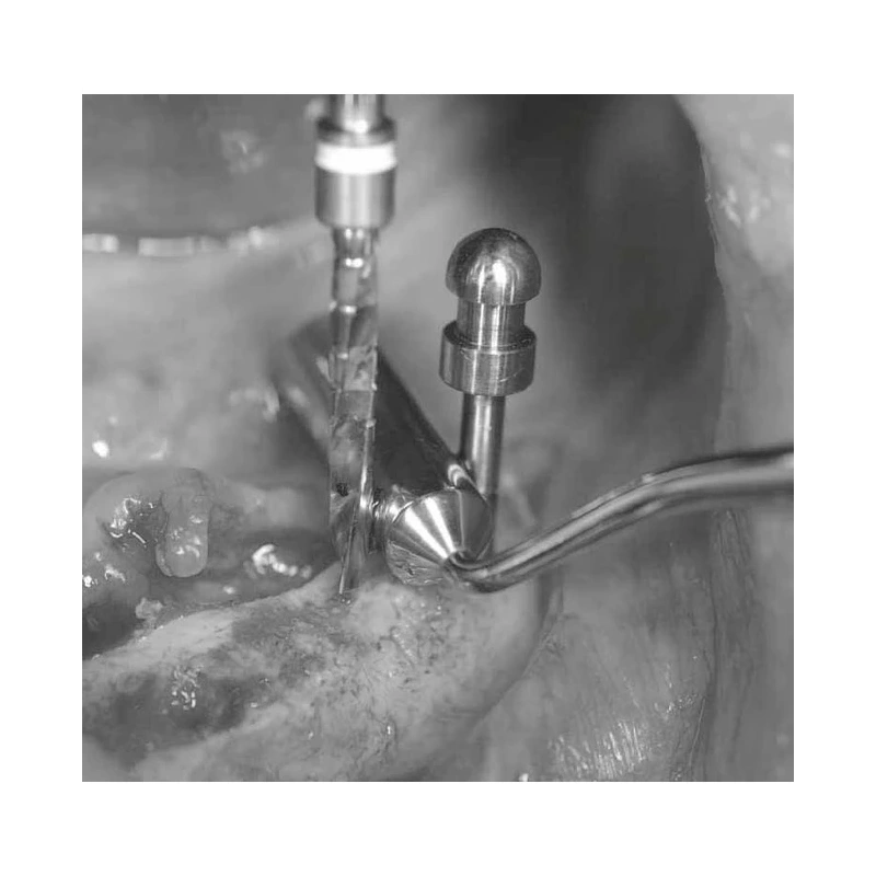 LM Implant Misura MR 3.4-5.8 - инструмент для позиционирования имплантатов | LM-Instruments Oy (Финляндия)