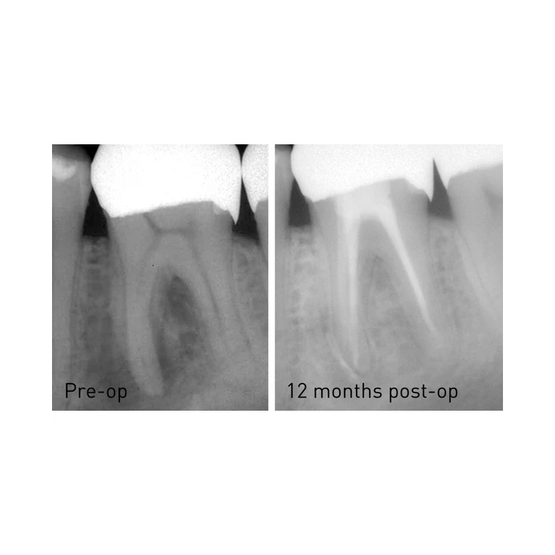 FONALaser - стоматологический диодный лазер | FONA Dental s.r.o. (Италия)