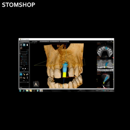 CS 8100 3D - дентальный трехмерный томограф, FOV 8х9 см | Carestream Dental (США)