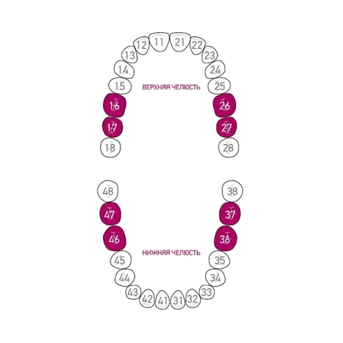 Кламмер для раббердама №202 Black с черным оксидным покрытием | Dentech Corporation (Япония)