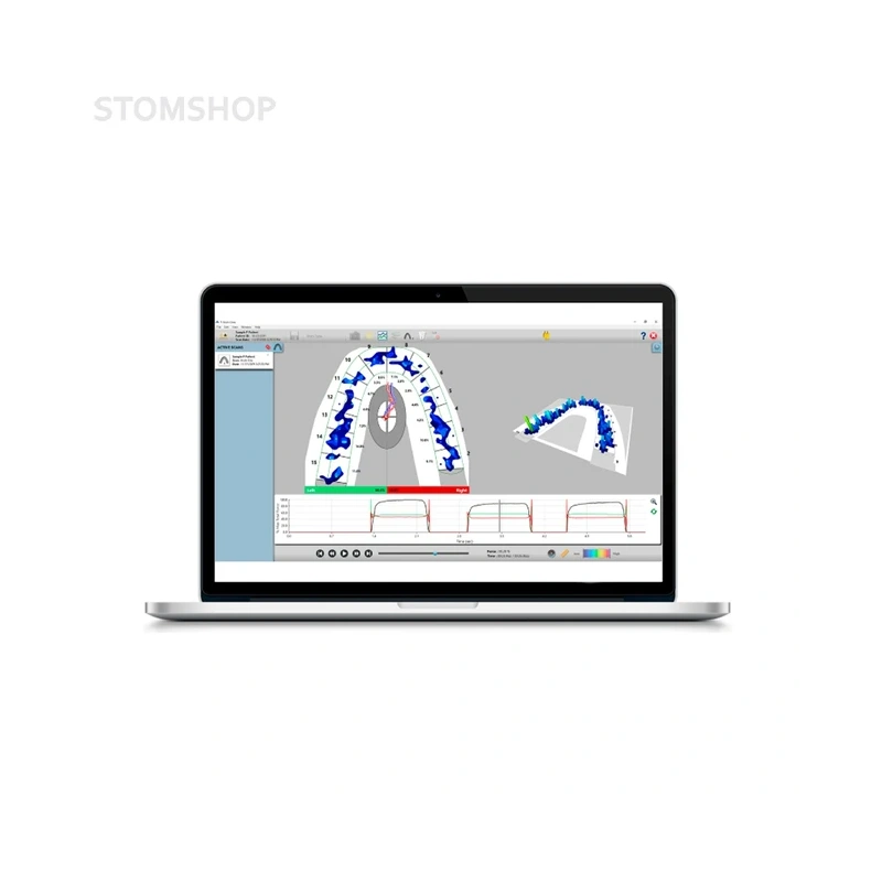 T-Scan Novus Core - аппарат для цифрового анализа окклюзии | Tekscan (США)