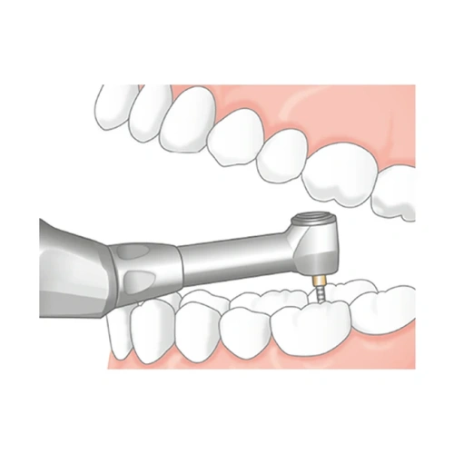 Endo-Mate TC2 MPA - беспроводной эндомотор с возможностью быстрого подключения апекслокатора | NSK Nakanishi (Япония)