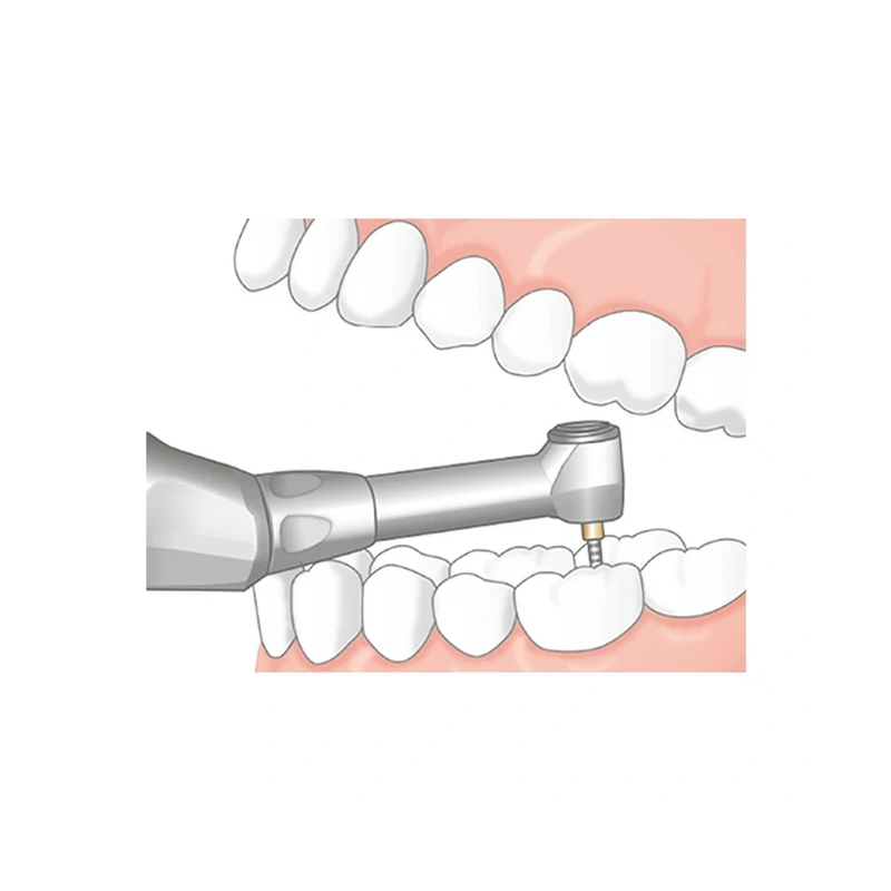 Endo-Mate TC2 MPA - беспроводной эндомотор с возможностью быстрого подключения апекслокатора | NSK Nakanishi (Япония)